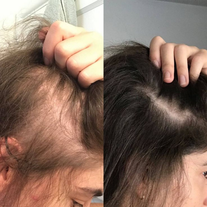 Restvive - Hair Growth Spray
