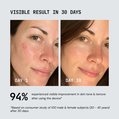 Restvive Red Light Therapy Device